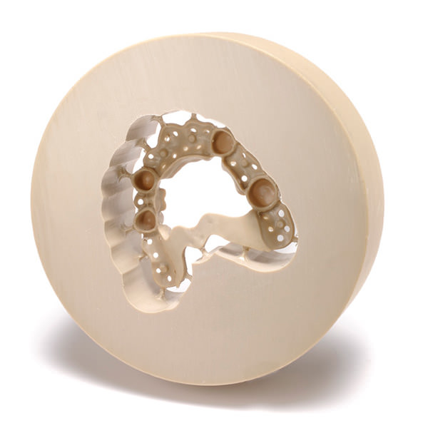 PEEK – A New Material for CAD CAM Dentistry